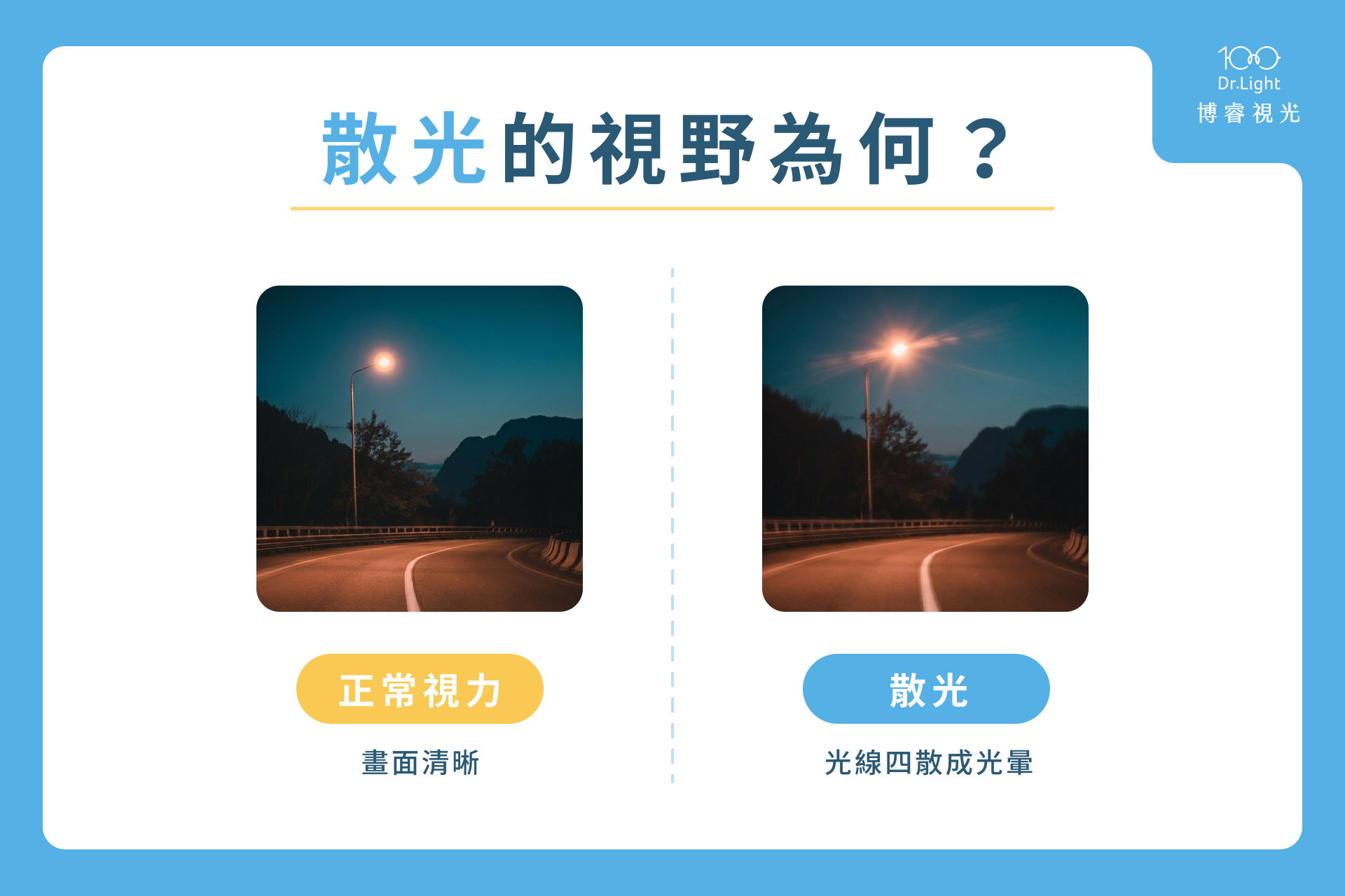 散光 4 大症狀